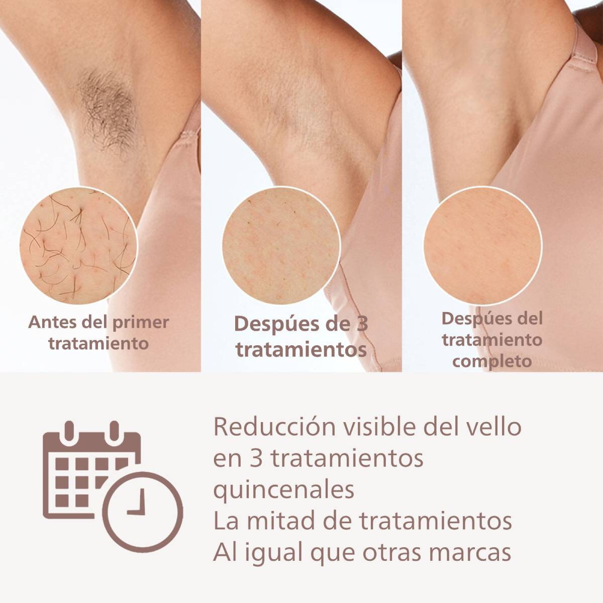 Philips Lumea Depiladora Series 8000