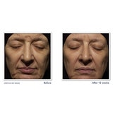 Roc Juego de Crema de Noche con Retinol