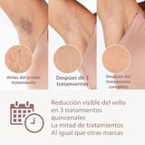 Philips Lumea Depiladora Series 8000