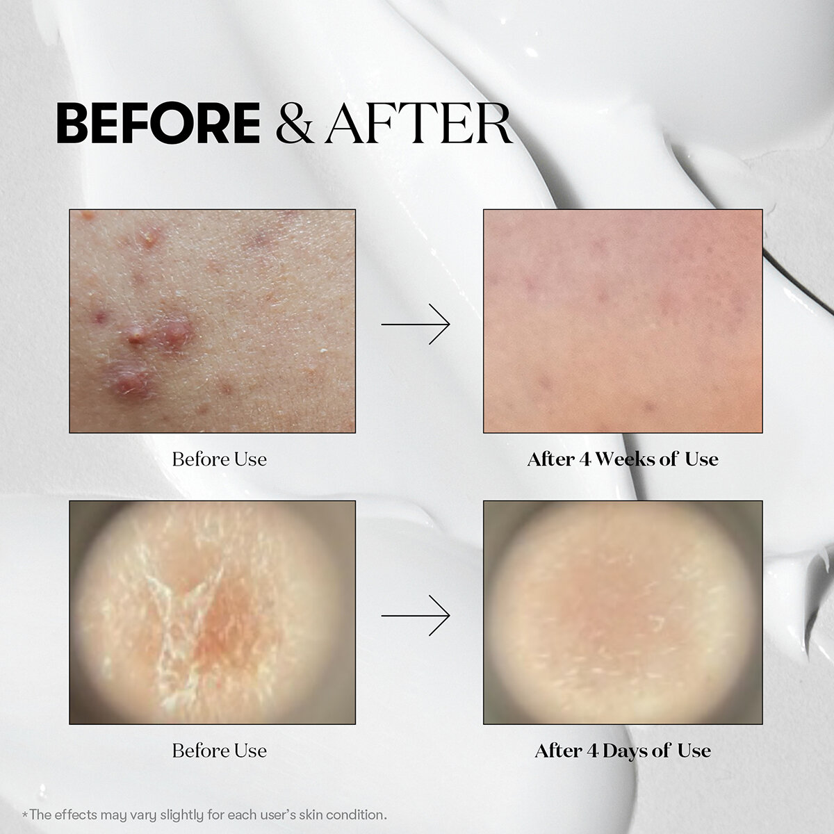 VT Reedle Shot 100 50 ml + 30 ml VT Reedle Shot 100 50 ml + 30 ml